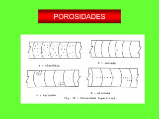 POROSIDADES
 