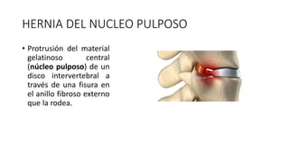 HERNIA DEL NUCLEO PULPOSO
• Protrusión del material
gelatinoso central
(núcleo pulposo) de un
disco intervertebral a
través de una fisura en
el anillo fibroso externo
que la rodea.
 