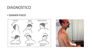 DIAGNOSTICO
• EXAMEN FISICO
 