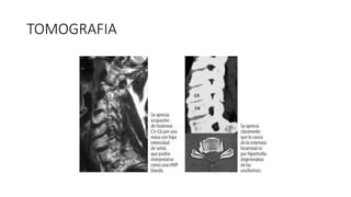 TOMOGRAFIA
 