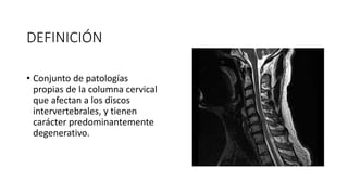 DEFINICIÓN
• Conjunto de patologías
propias de la columna cervical
que afectan a los discos
intervertebrales, y tienen
carácter predominantemente
degenerativo.
 