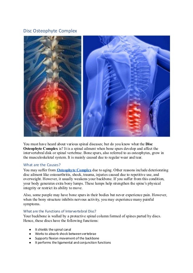 Disc osteophyte complex blog.docx