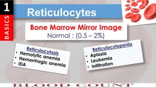 B
A
S
I
C
S
1 Reticulocytes
Bone Marrow Mirror Image
Normal : (0.5 – 2%)
 