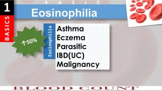 B
A
S
I
C
S
1 Eosinophilia
B A S I C
Eosinophilia
Asthma
Eczema
Parasitic
IBD(UC)
Malignancy
 