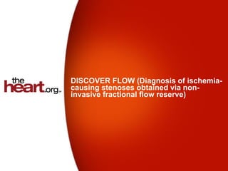 DISCOVER FLOW (Diagnosis of ischemia-
causing stenoses obtained via non-
invasive fractional flow reserve)
 