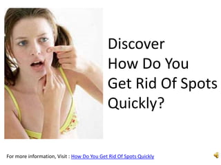 Discover
                                            How Do You
                                            Get Rid Of Spots
                                            Quickly?


For more information, Visit : How Do You Get Rid Of Spots Quickly
 