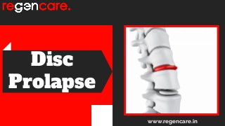 Disc
Prolapse
www.regencare.in
 