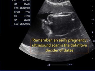 Remember, an early pregnancy
ultrasound scan is the definitive
        decider of dates
 