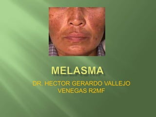 DR. HECTOR GERARDO VALLEJO
       VENEGAS R2MF
 