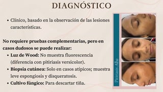 DISCROMIAS. APRENDE A DIFERENCIAR LAS DISCROMIAS | PDF