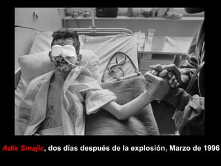 Adis Smajic , dos días después de la explosión, Marzo de 1996 