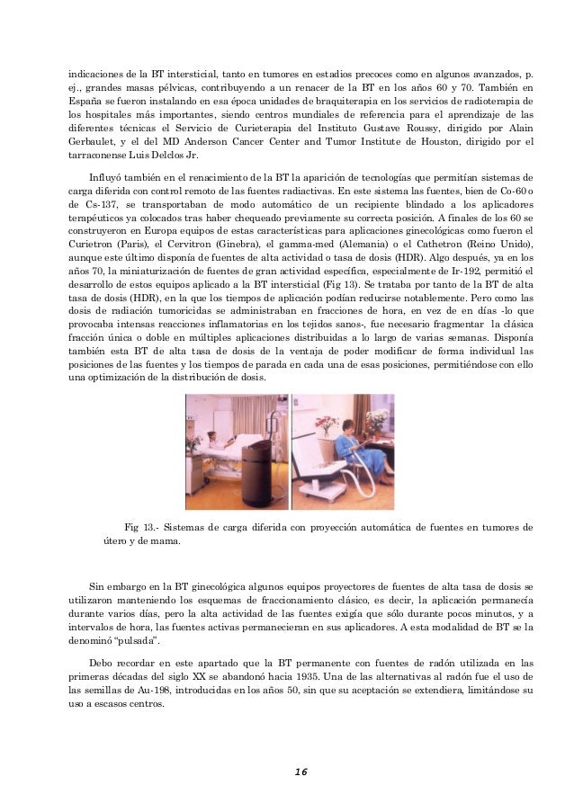 agujas y templates braquiterapia intersticial de mama historia de la braquiterapia ilmo sr dr d ignacio agujas y templates braquiterapia intersticial de mama historia de la braquiterapia ilmo sr dr d ignacio