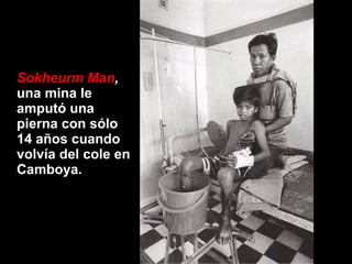 Sokheurm Man ,  una mina le amputó una pierna con sólo 14 años cuando volvía del cole en Camboya.   