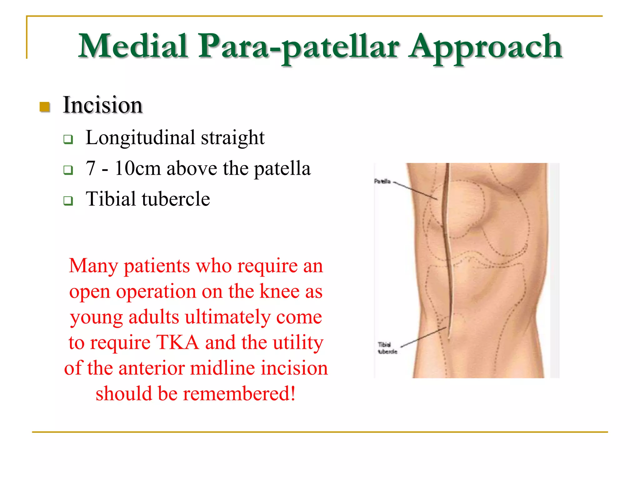 Longitudinal Incision Leg Discuss approaches to the knee and Describe in detail TKR | PPTX