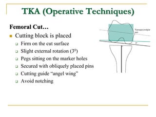 TKA (Operative Techniques)
Femoral Cut…
 Cutting block is placed
 Firm on the cut surface
 Slight external rotation (30...