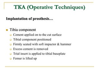 TKA (Operative Techniques)
Implantation of prosthesis…
 Tibia component
 Cement applied on to the cut surface
 Tibial c...