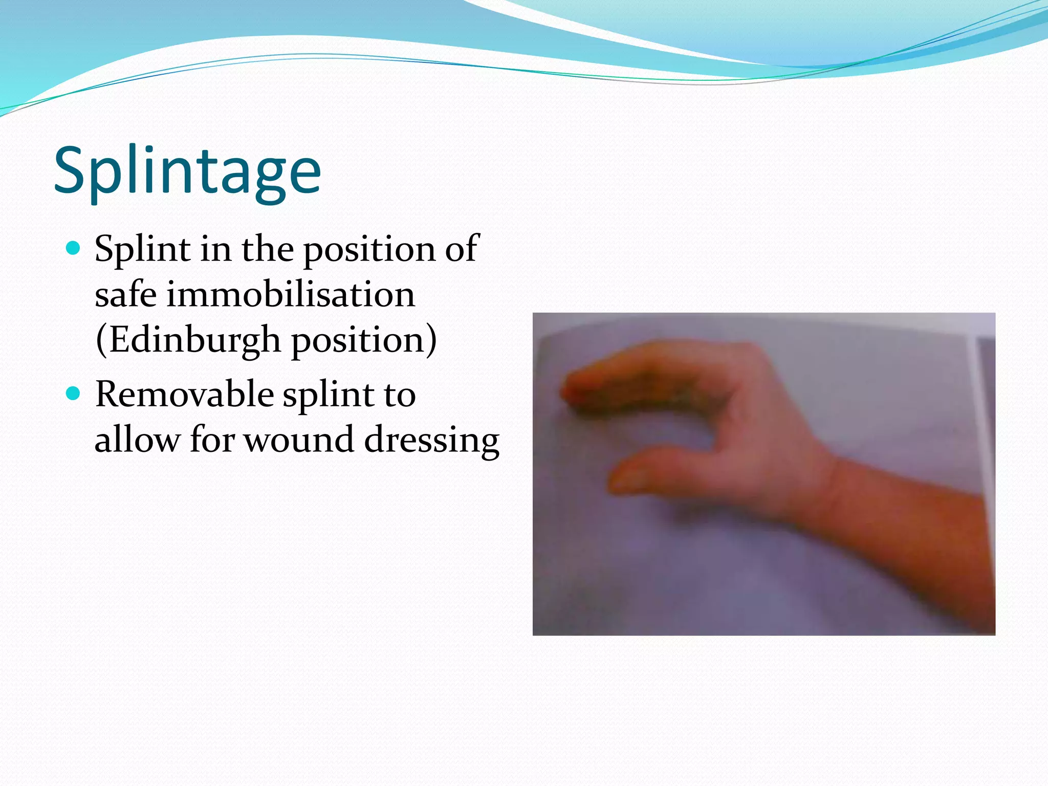 Splintage
 Splint in the position of
safe immobilisation
(Edinburgh position)
 Removable splint to
allow for wound dressing
 