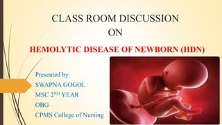 CLASS ROOM DISCUSSION
ON
HEMOLYTIC DISEASE OF NEWBORN (HDN)
Presented by
SWAPNA GOGOI.
MSC 2ND YEAR
OBG
CPMS College of Nursing
 