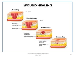 Discuss keloid and hypertrophic scars | PDF