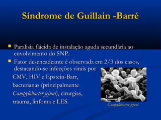 Síndrome de Guillain -Barré

 Paralisia flácida de instalação aguda secundária ao
  envolvimento do SNP.
 Fator desencadeante é observada em 2/3 dos casos,
  destacando-se infecções virais por
 CMV, HIV e Epstein-Barr,
 bacterianas (principalmente
 Campylobacter jejuni), cirurgias,
 trauma, linfoma e LES.                    Campylobacter jejuni
 