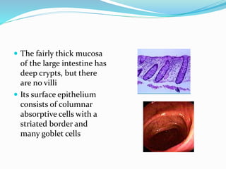 Colonic Crypt Polyp Discuss the management of colonic polyps | PPTX