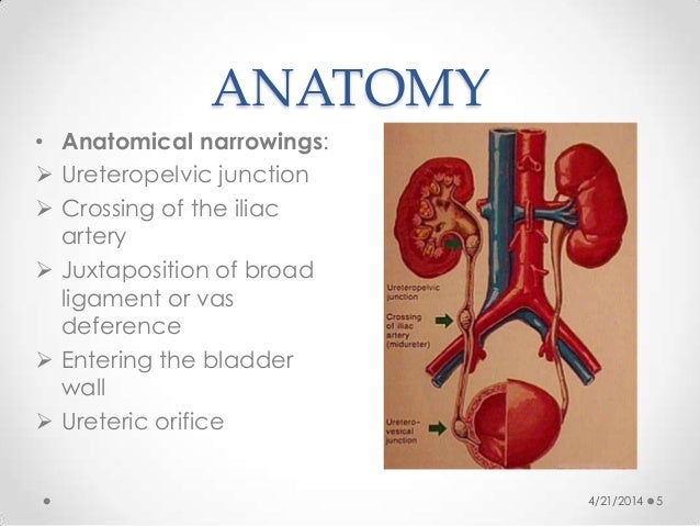 management of urinary calculus