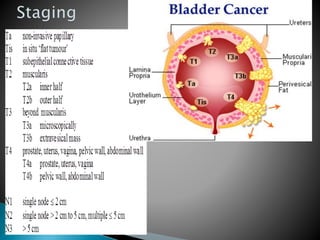 Discuss the pathology of bladder cancers | PPTX
