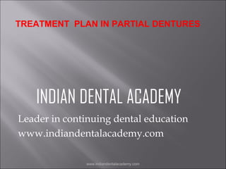 TREATMENT PLAN IN PARTIAL DENTURES

INDIAN DENTAL ACADEMY
Leader in continuing dental education
www.indiandentalacademy.com
www.indiandentalacademy.com

 