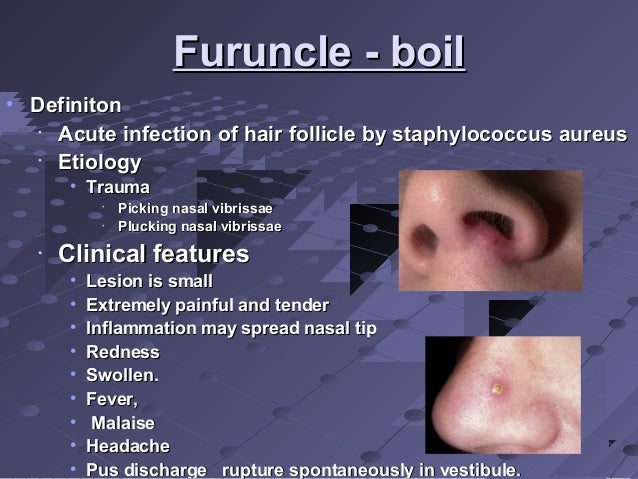 Natural Ways To Cure Tooth Infection Natural Ways To Cure Tooth Infection