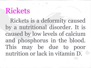 Rickets
  Rickets is a deformity caused
by a nutritional disorder. It is
caused by low levels of calcium
and phosphorus in the blood.
This may be due to poor
nutrition or lack in vitamin D.
 