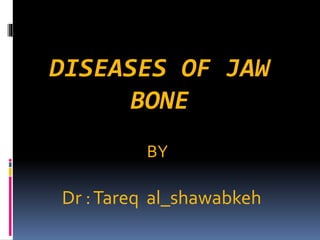 DISEASES OF JAW
BONE
Dr :Tareq al_shawabkeh
BY
 