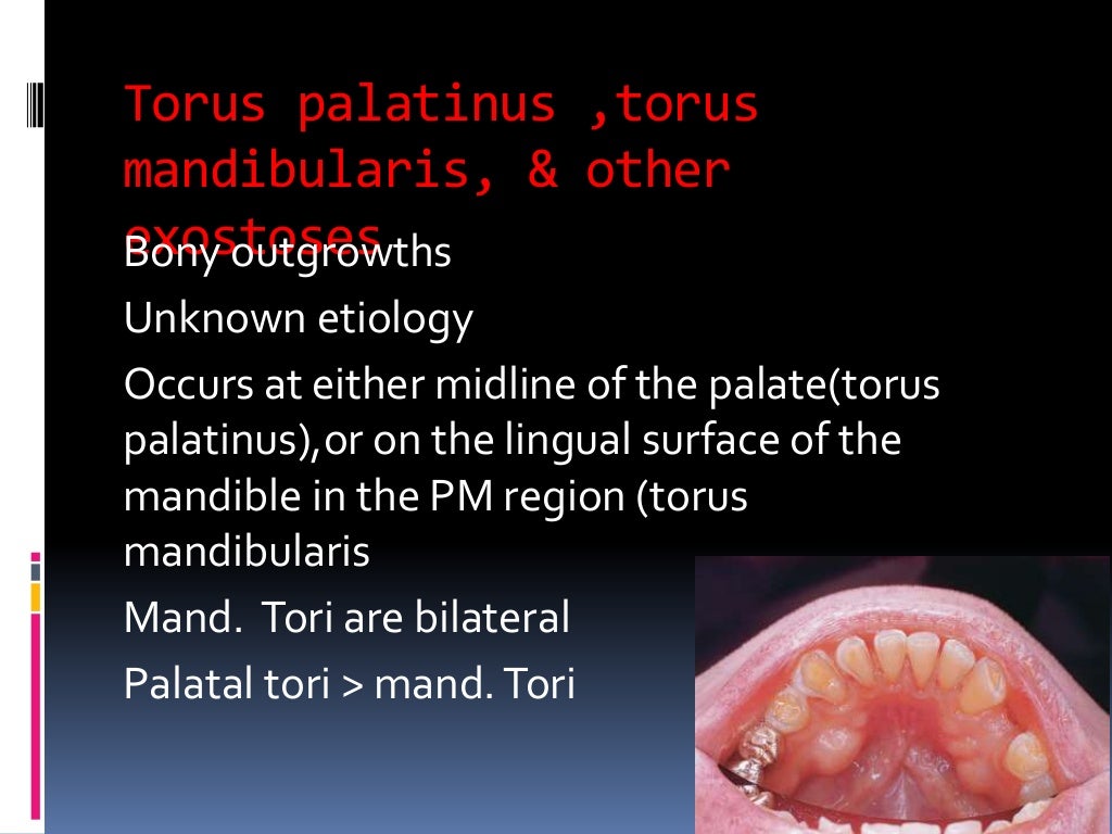 Oral pathology Disease ofjawbone