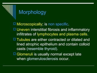Morphology
 Microscopically; is non specific.
 Uneven interstitial fibrosis and inflammatory

infiltrates of lymphocytes and plasma cells.
 Tubules are either contracted or dilated and
lined atrophic epithelium and contain colloid
casts (resemble thyroid).
 Glomeruli is usually normal except late
when glomerulosclerosis occur.

 
