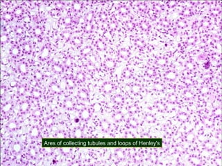 Ares of collecting tubules and loops of Henley's

 
