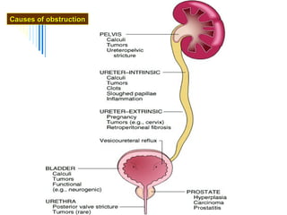 Causes of obstruction

 