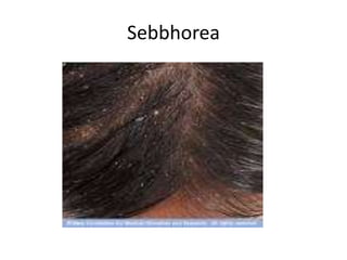 Hot topic Skinification of the scalp