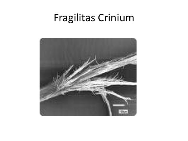pediculosis capitis