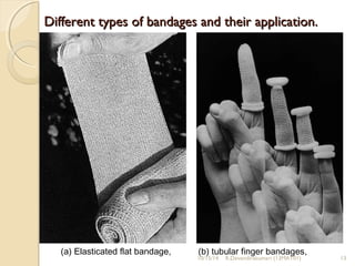 Different types of bandages aanndd tthheeiirr aapppplliiccaattiioonn.. 
(a) Elasticated flat bandage, (b) tubular finger bandages, 
10/15/14 R.Devendirakumari (13MAT01) 13 
 