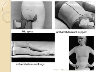 Hip spica lumbar/abdominal support 
anti-embolism stockings. 
10/15/14 R.Devendirakumari (13MAT01) 18 
 