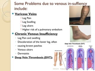 Some Problems due to venous in-suffiency 
include: 
Varicose Veins 
 Leg Pain 
 Leg Swelling 
 Leg ulcers 
 Higher risk of a pulmonary embolism 
Chronic Venous Insufficiency 
◦ Leg Pain and swelling 
◦ Discoloration of the lower leg, often 
◦ causing brown patches 
◦ Venous ulcers 
◦ Dermatitis 
 Deep Vein Thrombosis (DVT): 
10/15/14 R.Devendirakumari (13MAT01) 26 
 