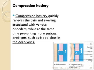 Compression hosiery 
Compression hosiery quickly 
relieves the pain and swelling 
associated with venous 
disorders, while at the same 
time preventing more serious 
problems, such as blood clots in 
the deep veins. 
10/15/14 R.Devendirakumari (13MAT01) 28 
 
