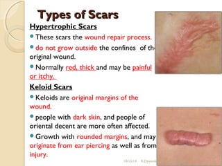 TTyyppeess ooff SSccaarrss 
Hypertrophic Scars 
These scars the wound repair process. 
do not grow outside the confines of the 
original wound. 
Normally red, thick and may be painful 
or itchy. 
Keloid Scars 
Keloids are original margins of the 
wound. 
people with dark skin, and people of 
oriental decent are more often affected. 
Growth with rounded margins, and may 
originate from ear piercing as well as from 
injury. 
10/15/14 R.Devendirakumari (13MAT01) 32 
 