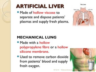 AARRTTIIFFIICCIIAALL LLIIVVEERR 
Made of hollow viscose to 
separate and dispose patients’ 
plasmas and supply fresh plasma. 
MECHANICAL LUNG 
Made with a hollow 
polypropylene fibre or a hollow 
silicone membrane. 
Used to remove carbon dioxide 
from patients’ blood and supply 
fresh oxygen. 
10/15/14 R.Devendirakumari (13MAT01) 39 
 