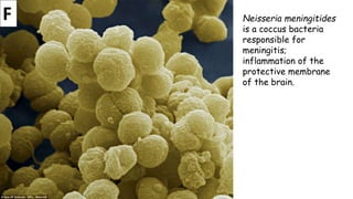 F

Neisseria meningitides
is a coccus bacteria
responsible for
meningitis;
inflammation of the
protective membrane
of the brain.

 