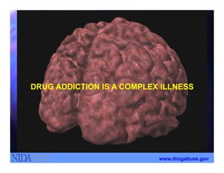 DRUG ADDICTION IS A COMPLEX ILLNESSDRUG ADDICTION IS A COMPLEX ILLNESSDRUG ADDICTION IS A COMPLEX ILLNESSDRUG ADDICTION IS A COMPLEX ILLNESS
www.drugabuse.gov
 