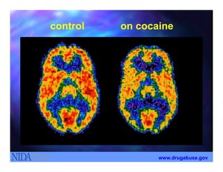 controlcontrol on cocaineon cocaine
www.drugabuse.gov
 