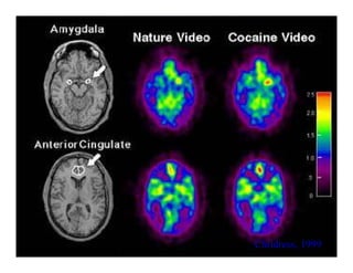 Childress, 1999Childress, 1999
 