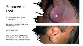 common disease of external ear.ppt orlhns | PPTX
