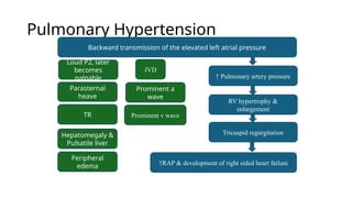 Palpable P2 DISEASE OF Mitral valve of human heart.pptx
