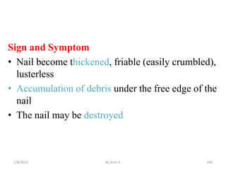 Sign and Symptom
• Nail become thickened, friable (easily crumbled),
lusterless
• Accumulation of debris under the free ed...
